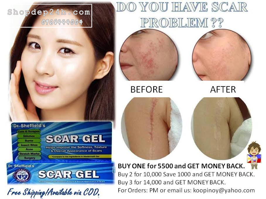 [Dr. Sheffield's] Trị sẹo và vết rổ DR. SHEFFIELD'S SCAR GEL 1oz/28g